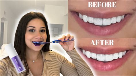 Say Goodbye to Stains: The Magic of Whitening Toothpaste Revealed